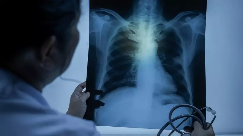 50 Yaş Üstü Sigara Tiryakileri Dikkat! Bu Hayat Kurtaran Testi Sakın Atlatmayın