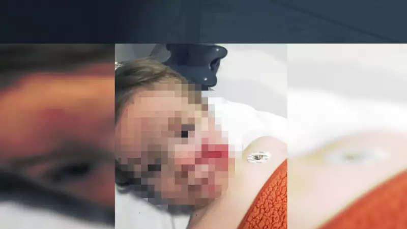 Ankara'da Pitbull Saldırısı: 1,5 ve 5 Yaşındaki Kardeşler Yaralandı