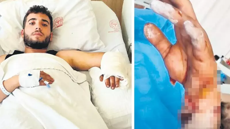 Ankara'da Sokak Köpeği Saldırısı: MS Hastası Gencin Hayatı Tehlikeye Girdi!