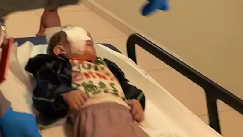 Bursa'da 2 yaşındaki çocuğun gözüne torpil isabet etti: Görme yetisi kayboldu