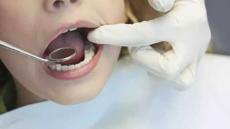 Diş Çürükleri İnme Riskini %44 Artırıyor: Uzmanlar Uyarıyor