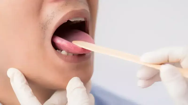 Diliniz Sağlığınız Hakkında Ne Söylüyor? 700 Bakteri Türü İpuçları Veriyor