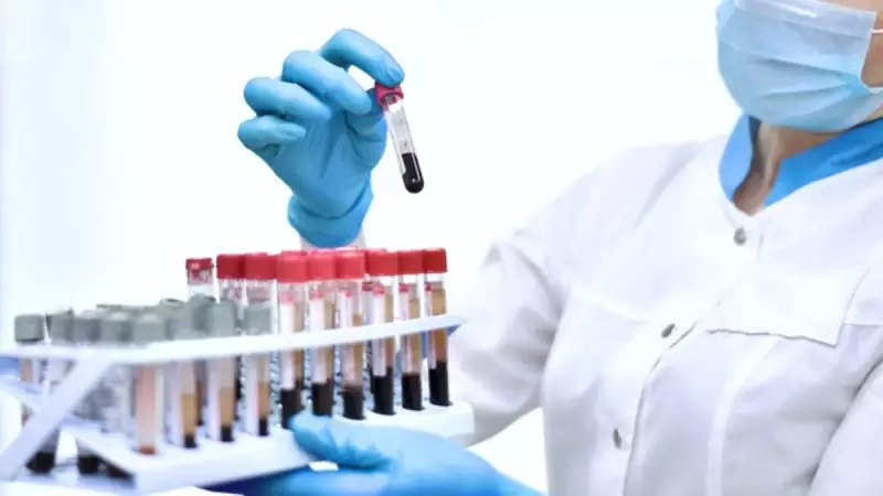 Dünyada Sadece 50 Kişide Bulunan Altın Kan: Rh Null