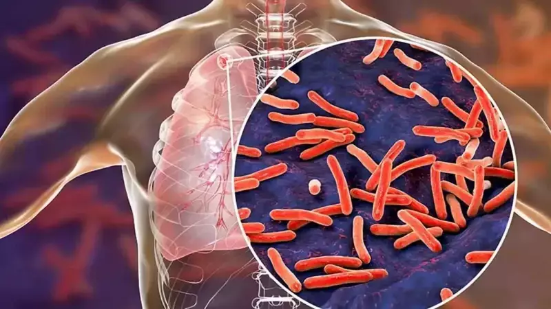 DSÖ Raporu: Verem 2024'te 1,2 Milyon Can Aldı