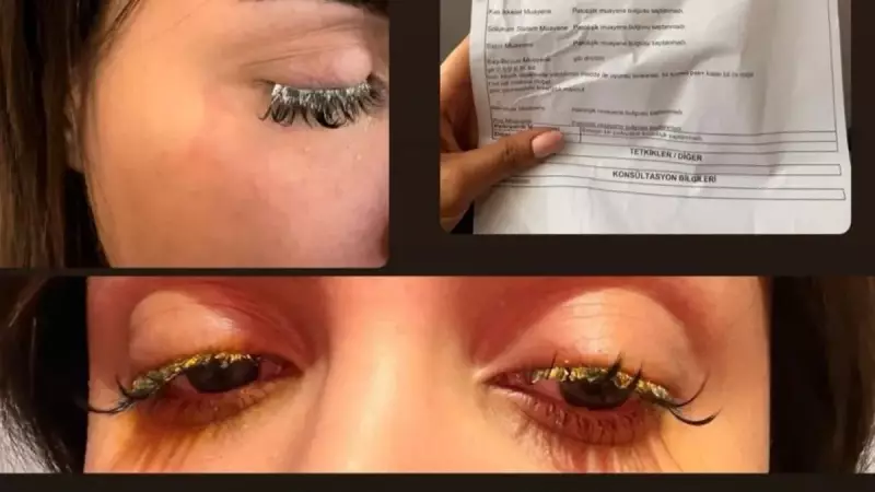 Esenyurt'ta Kirpik Lifting Felaketi: Genç Kadın Kör Olma Tehlikesi Yaşadı