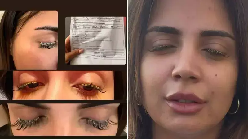 Esenyurt'ta Kirpik Uygulaması Genç Kadını Kör Edecekti