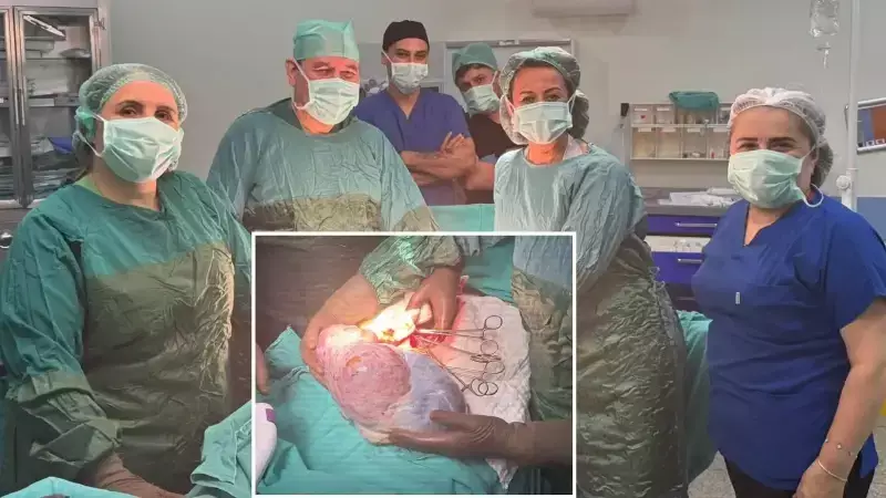 Şişkinlik Sandı, Dev Kitle Çıktı! Ameliyatta 5 Kiloluk Şok