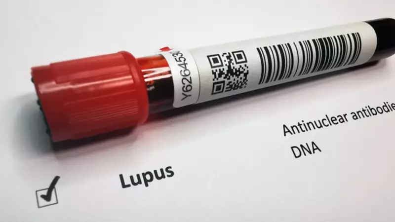 Lupusun Gizemi Çözüldü: Epstein-Barr Virüsü Suçlu!