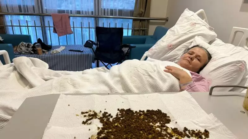 Manisa'da 70 Yaşındaki Kadının Safra Kesesinden 20.000'den Fazla Taş Çıkarıldı