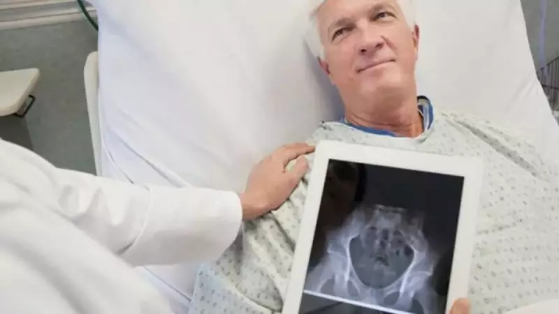 Mesane Kanseri Uyarısı: Bu Belirtileri Hafife Almayın, Risk 4 Kat Artıyor