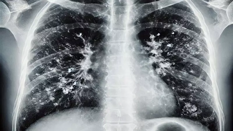 Prof. Dr. Alper Şener'den Kritik Süperenfeksiyon Uyarısı!