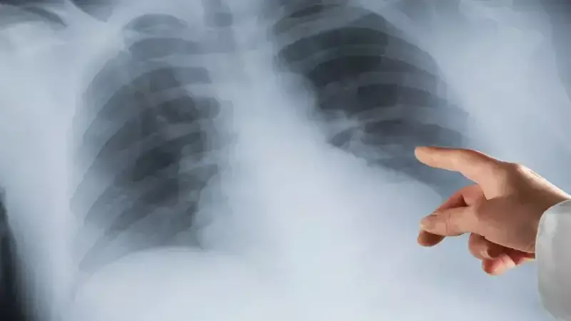 Sigara İçmeyenleri de Zehirliyor! Pasif İçicilikteki Gizli Tehlike ve Geri Dönüşü Olmayan Hasarlar