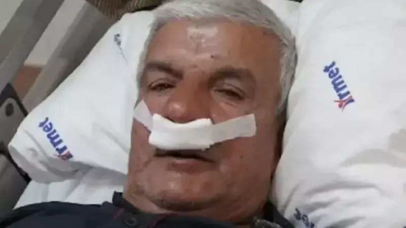 65 Yaşındaki İşçinin Burnundan 100 Gramlık Beton Taşı Çıkarıldı