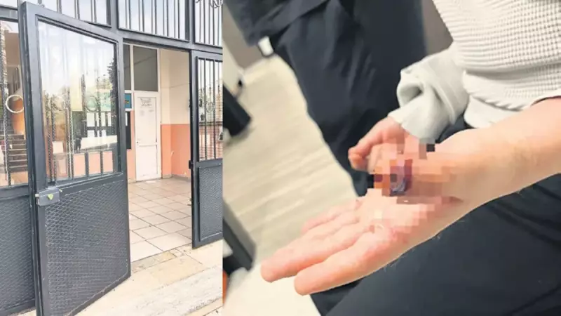 Bayrampaşa'da 7 Yaşındaki Çocuğun Parmağı Okul Kapısında Koptu