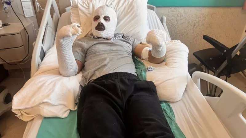 Kars'ta Gaz Kaçağı Patlaması: İşitme Engelli Genç Çay Demlerken Ev Havaya Uçtu