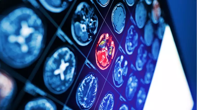 İnmede Yanlış Müdahale Hayatı Tehdit Ediyor: Prof. Dr. İpek Midi Uyardı