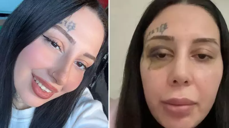 İstanbul'da Burun Estetiği Krizi: Eşini Silahla Tehdit Eden Koca Tutuklandı