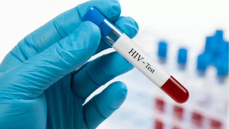 Türkiye'de HIV Vakaları Artıyor: Uzmanlar Uyarıyor