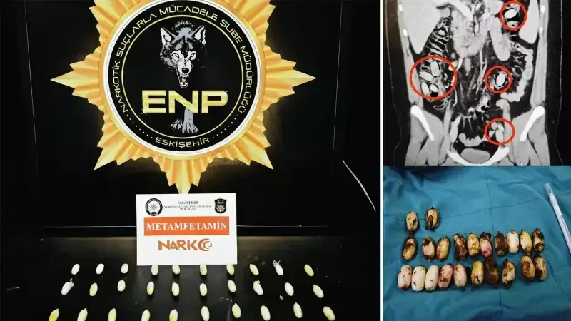 Eskişehir'de Midesinde 44 Kapsül Bonzai ile Yakalanan Şüpheli Tutuklandı
