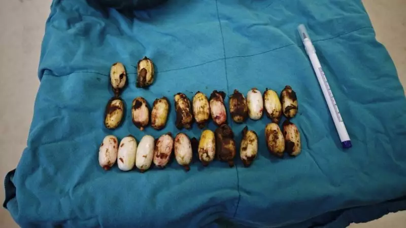 Eskişehir'de Midesinde 44 Kapsül Uyuşturucu Bulunan Yabancı Uyruklu Tutuklandı