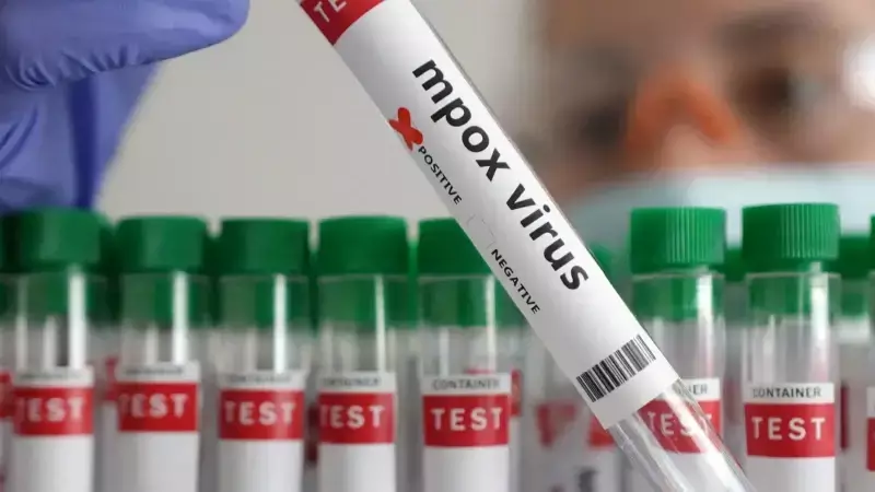 Gana'da M Çiçeği Vakaları Artıyor: Haftada 19 Yeni Vaka, Toplam 980'e Ulaştı