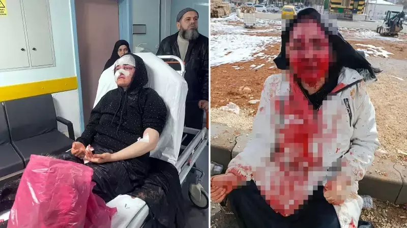 Gaziantep'te Boşanma Sürecindeki Kadın Kaldırım Taşıyla Dövüldü: Yoğun Bakımda