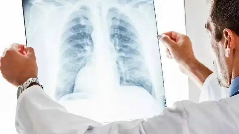 Gaziantep'te Zatürre Vakalarında Artış: Uzmanlar Uyarıyor