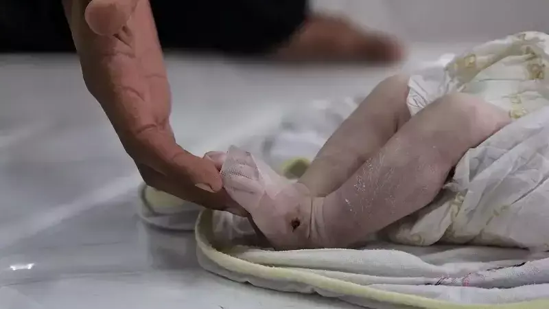 Gazze'de İsrail Saldırıları ve Kış Şartları Altındaki Çevresel Yıkım, 6 Aylık Bebek Yusuf'un Hayatına Mal Oldu
