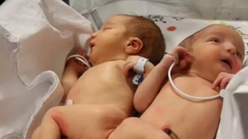 Hatay'da Deprem ve Cinayetle Öksüz Kalan Siyam İkizlerinden Ali Haydar Hayatını Kaybetti