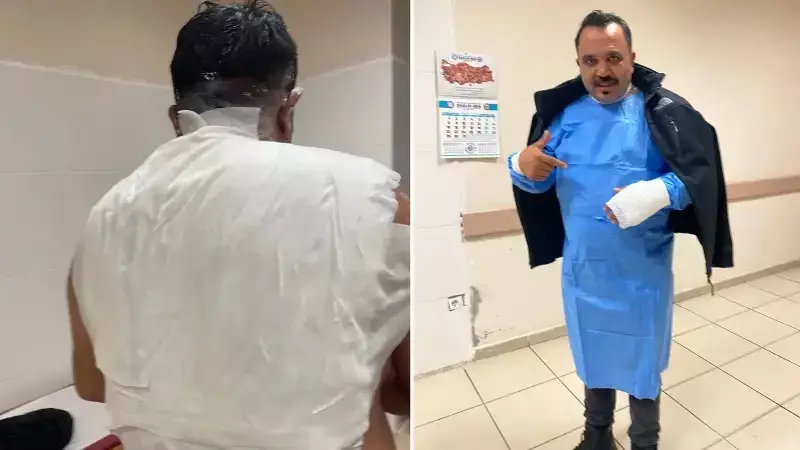 Sivas'ta Soğuk Hava Deneyi Korkunç Bitti: İşletmeci Yanıklarla Hastanelik Oldu