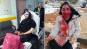Gaziantep'te Boşanma Sürecindeki Kadın Kaldırım Taşıyla Dövüldü: Yoğun Bakımda