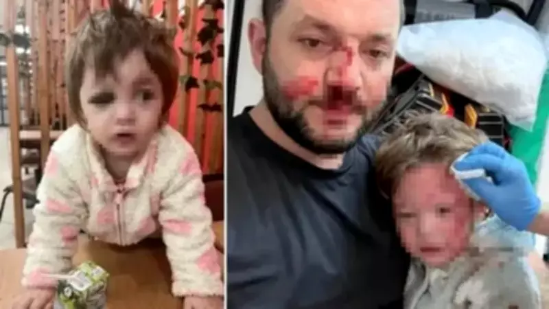 Baba ve Bebek Kızına Scooter Saldırısı: Saldırgana 36 Yıla Kadar Hapis İstendi