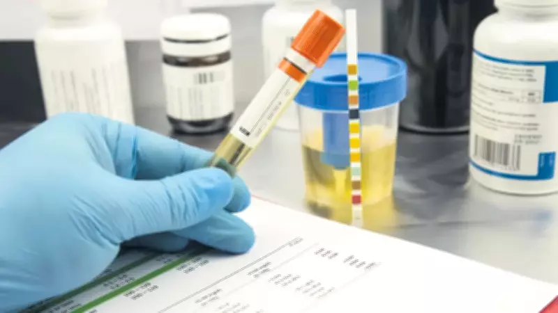 İş Başvurularında Madde Testi Zorunluluğu Yaygınlaşıyor: Fiyat 2.200 TL