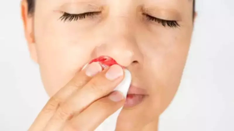 Burun Kanaması Orucu Bozar mı? Diyanet'in Açıklaması ve Detaylar