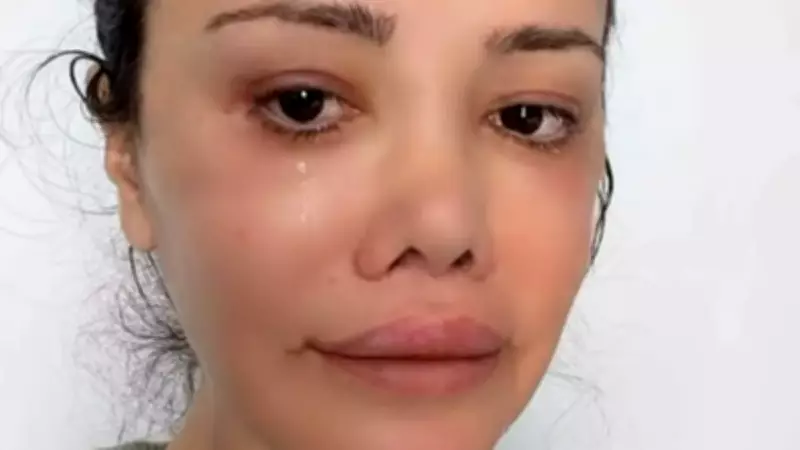 Didem Ceran Gözyaşları İçinde Açıkladı: 'Kanser Sürecindeyim'