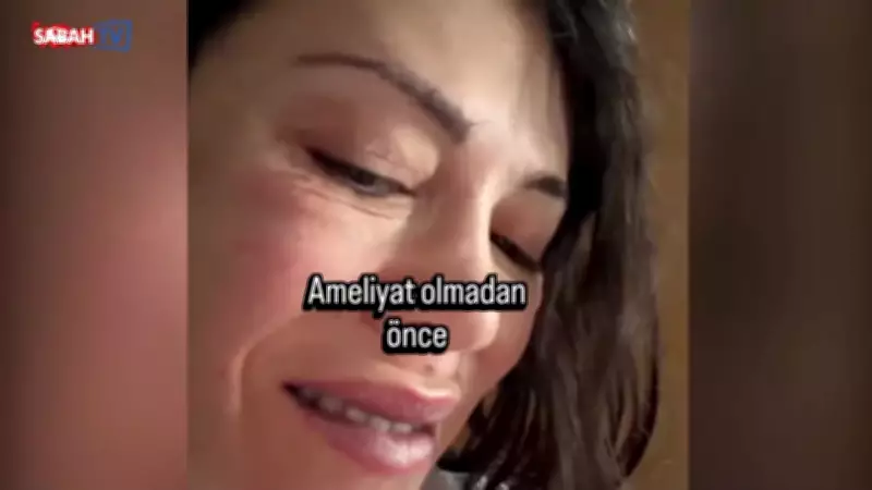 Didem Ceran'ın Kore'deki Yüz Nakli Ameliyatı Öncesi ve Sonrası Görüntüleri Şaşırttı