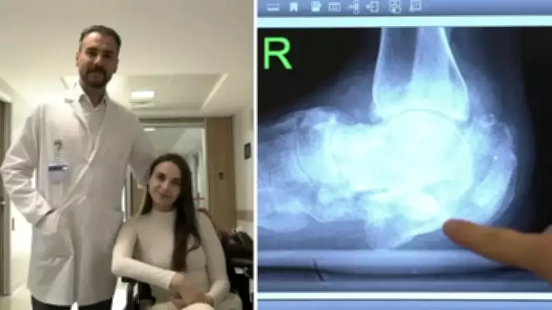 Diyabet Hastasının Ayağı Kurtarıldı: 'Sadece Ayağımı Değil, Hayatımı Geri Verdiler'