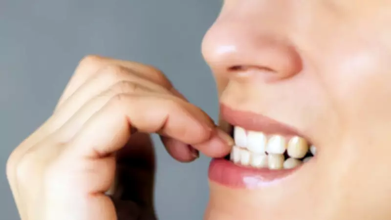 Diyanet Açıkladı: Tırnak Yemek Orucu Bozar mı?