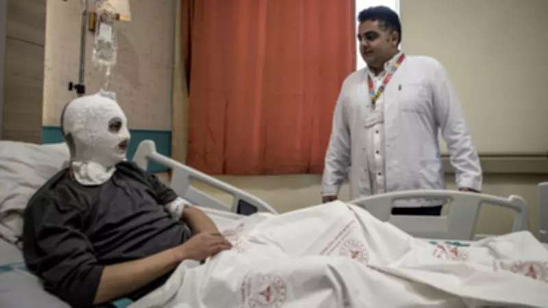 Erzurum'da Çakmak Gazı Faciası: 19 Yaşındaki Genç Yanık Tedavi Merkezinde