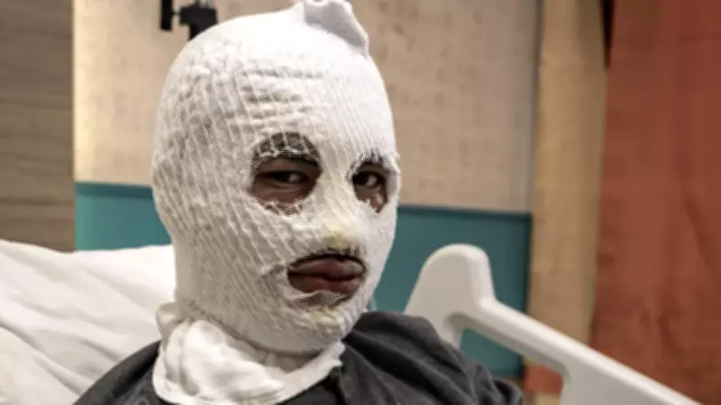 Erzurum'da Çakmak Gazı Tüpü Patladı: 19 Yaşındaki Genç Ölümden Döndü