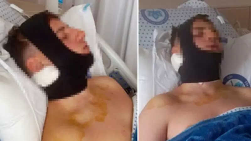 Eskişehir'de Lise Öğrencisine Okul Önünde Saldırı: Çene ve Omurilik Kırığı