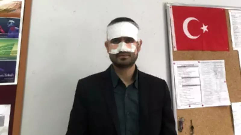 Eskişehir'de Lisede Şok Olay: Öğretmene Sıcak Çay Fırlatıldı, Yüzünde Yanık Oluştu