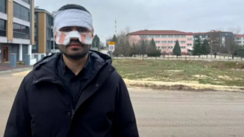 Eskişehir'de Şok Olay: Öğretmen, Meslektaşının Yüzüne Sıcak Çay Fırlattı