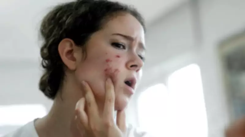 Gece Bakımında Yapılan Kritik Hata! Uzmanlar Uyarıyor: Akneye Davetiye Çıkarıyor