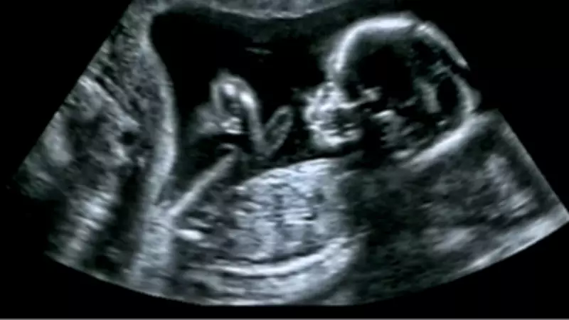 Kalp Sağlığı Anne Karnında Başlıyor: Prof. Dr. Yener'den Kritik Uyarılar