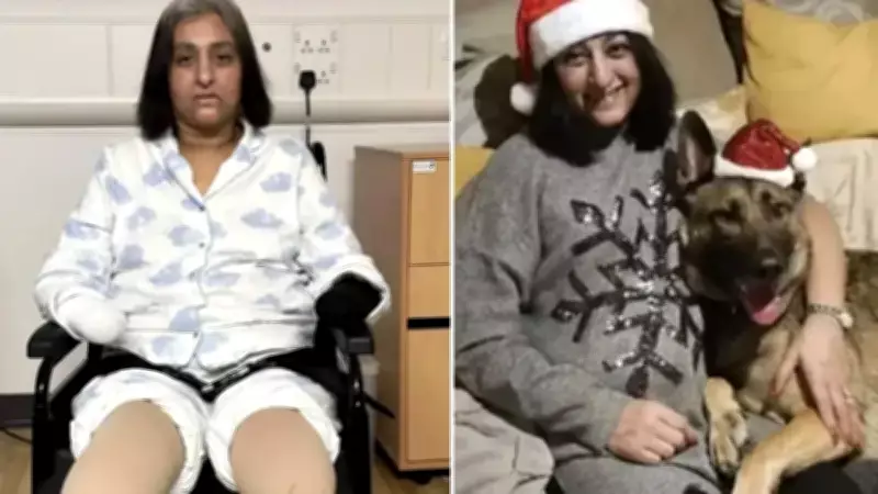 Köpek Yalamasından Korkunç Sonuç: 4 Uzuv Amputasyonu Yaşandı