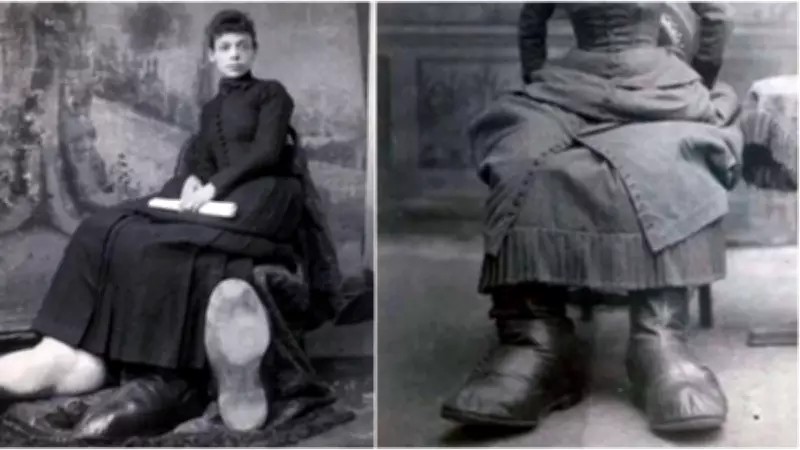 Çorap Yerine Yastık Kılıfı Giyen Kadın: Fanny Mills'in Sıra Dışı Hayat Hikayesi