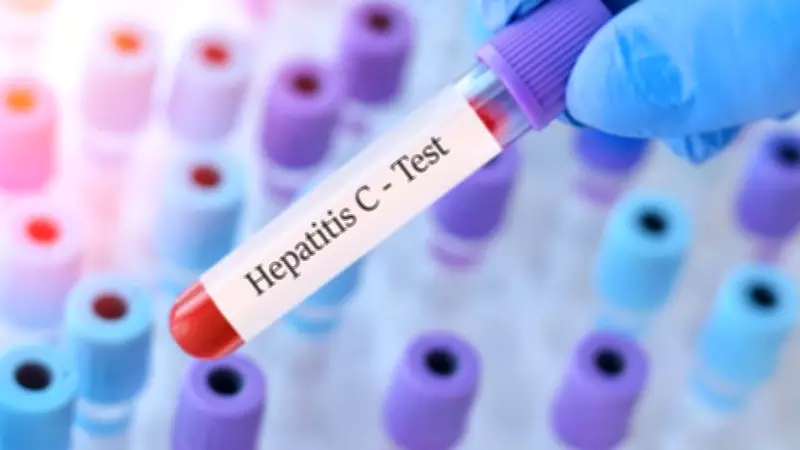 Sahte Sağlıkçılar Kapı Kapı Gezip Hepatit C Virüsünü Yayıyor