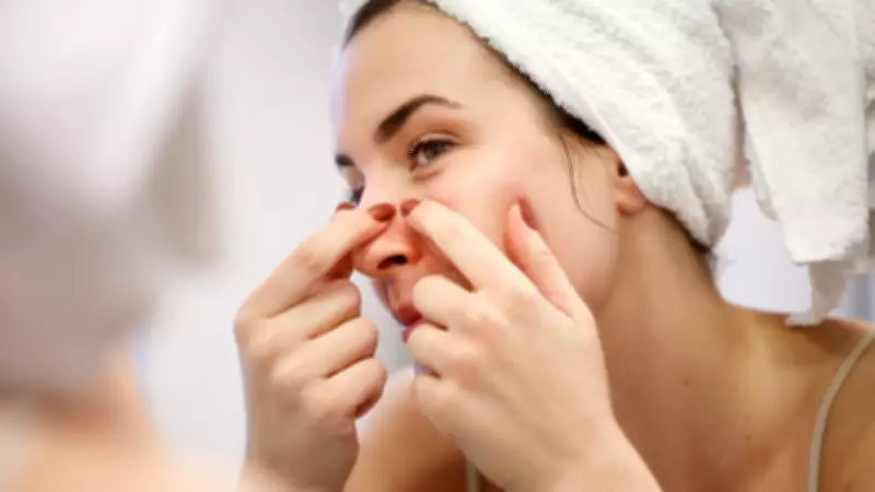 Sivilce Patlatmak Güzellik İçin Yapılan En Büyük Hata! İşte Doğru Bilgiler