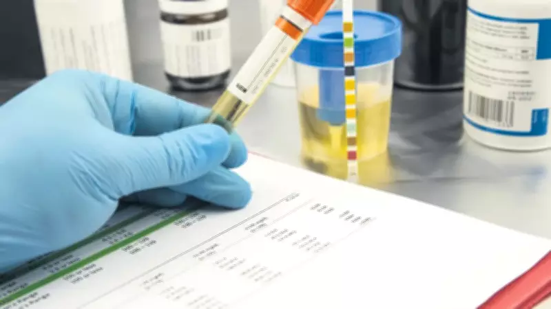 İşverenler İşe Alımda Madde Testi Uygulamasını Başlattı